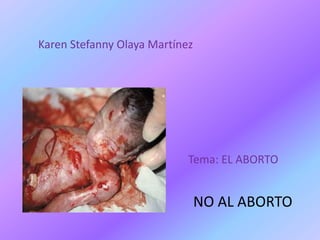 Karen Stefanny Olaya Martínez




                            Tema: EL ABORTO


                                NO AL ABORTO
 