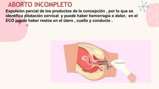 ABORTO INCOMPLETO
Expulsión parcial de los productos de la concepción , por lo que se
identifica dilatación cervical y puede haber hemorragia o dolor, en el
ECO puede haber restos en el útero , cuello y conducto .
 