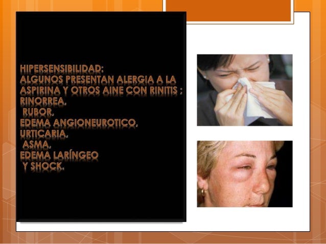 Presentacion aines 2015 Presentacion aines 2015