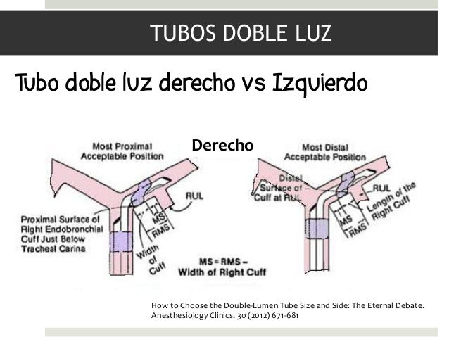Resultado de imagen para TUBO DOBLE LUZ COLOCACION