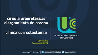 cirugía preprotesica:
alargamiento de corona
clínica con osteotomía
Daniel Ardila
Periodoncia 2022-2
 