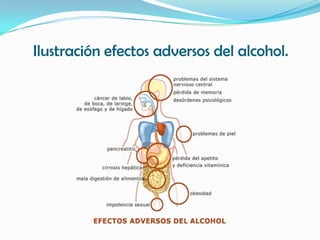 Ilustración efectos adversos del alcohol.
 