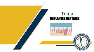 Tema
IMPLANTES DENTALES
 