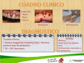 ETIOLOGIAEn la mayoría de los pacientes con anemia aplasica adquirida, la insuficiencia Medular se debe a una destrucción activa de mecanismo inmunológico de las células formadoras de  sangre por parte de los linfocitosMAS  FRECUENTES:Toxinas (Benceno, insecticidas).