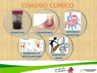 SENSIBILIDAD A INFECCIONESCUADRO CLINICODATOS DE LABORATORIOSANGRE PERIFERICA: Hematíes grandes, con plaquetas y granulocitos escasos.