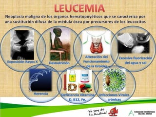  Suele mostrar escasez o ausencia completa de precursores eritroides y  mieloides (megacariocitos). Las extensiones de la muestra aspirada ofrecen solamente (Hematíes,    linfocitos residuales). Examen microscópico muestra que esta formada principalmente por grasa.TRATAMIENTOINTERVENCIONES :P.A.EEliminar  la exposición a factores de riesgo (radiaciones, medicamentos, toxinas).