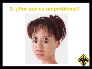 3. ¿Por qué es un problema?
Hombre de 15 años
no bebedor

Hombre de 15 años
consumo problematico

 