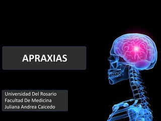 APRAXIAS


Universidad Del Rosario
Facultad De Medicina
Juliana Andrea Caicedo
 