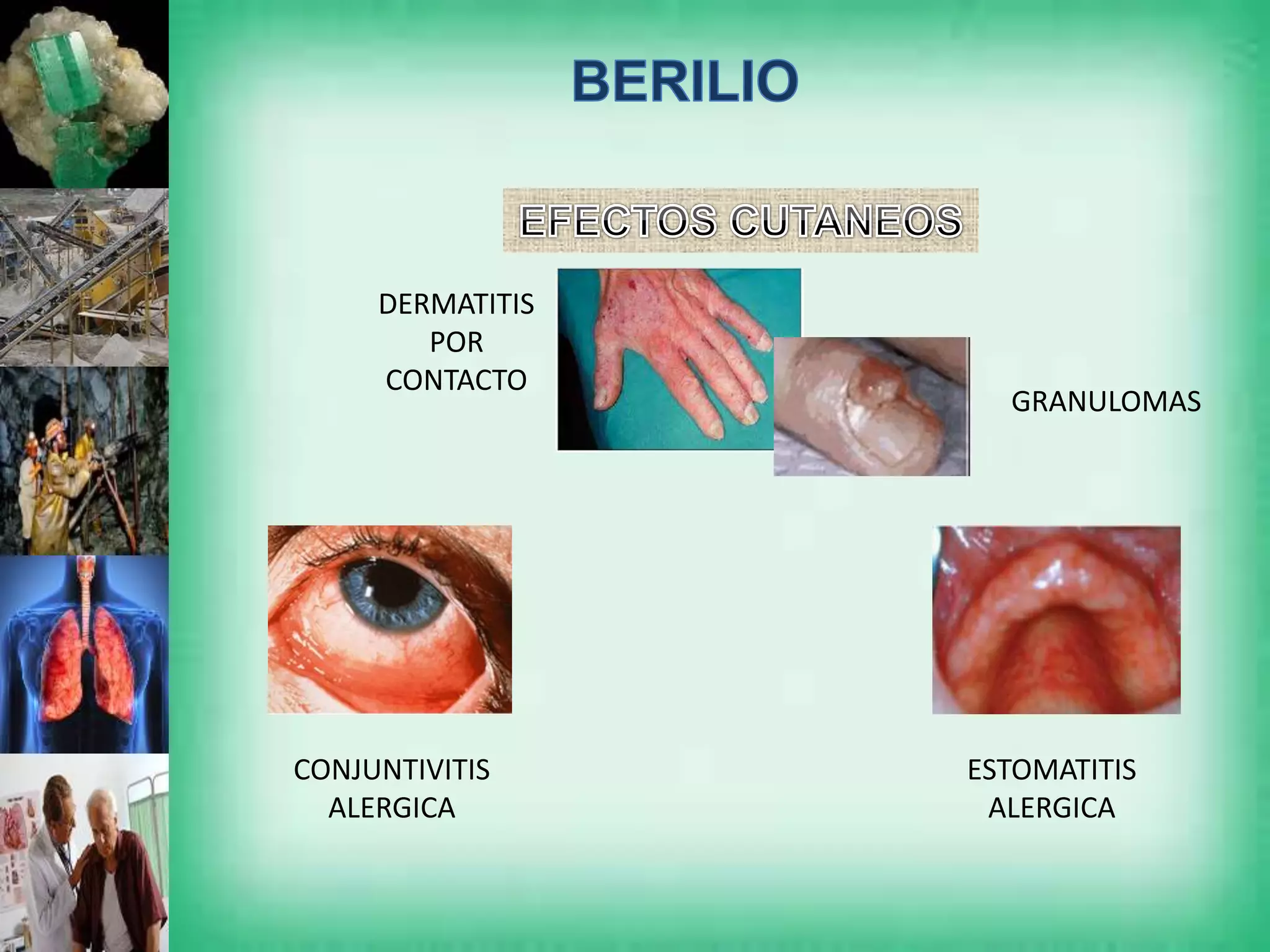 Metales Pesados. Berilio | PPTX