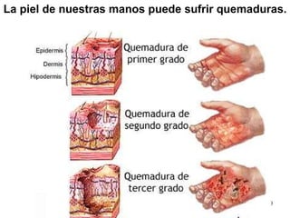 La piel de nuestras manos puede sufrir quemaduras. 