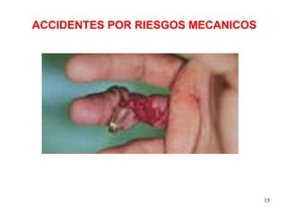 ACCIDENTES POR RIESGOS MECANICOS 