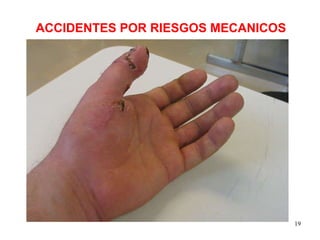 ACCIDENTES POR RIESGOS MECANICOS 