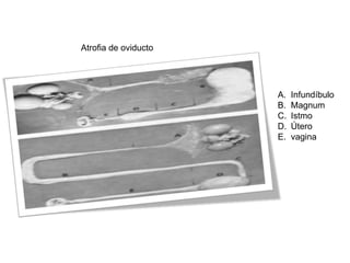 Atrofia de oviducto

A.
B.
C.
D.
E.

Infundíbulo
Magnum
Istmo
Útero
vagina

 