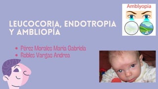 leucocoria, Endotropia
y ambliopía
Pérez Morales María Gabriela
Robles Vargas Andrea
 
