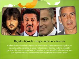 Cada método tiene la intención de eliminar cualquier exceso de tejido que
causa la caída, incluida la grasa y el músculo. Cuando todo va según lo
previsto durante el período de la cirugía y la recuperación, el resultado son
ojos rejuvenecidos y recuperarla mirada atractiva que tenia antes.
Hay dos tipos de cirugía, superior e inferior
 