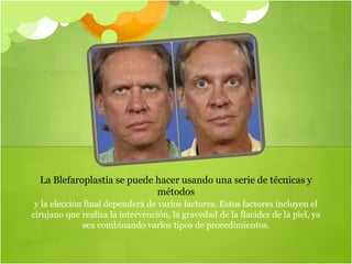 y la elección final dependerá de varios factores. Estos factores incluyen el
cirujano que realiza la intervención, la gravedad de la flacidez de la piel, ya
sea combinando varios tipos de procedimientos.
La Blefaroplastia se puede hacer usando una serie de técnicas y
métodos
 