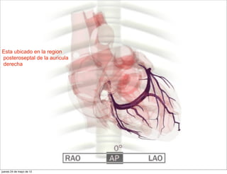 Esta ubicado en la region
posteroseptal de la auricula
derecha




jueves 24 de mayo de 12
 