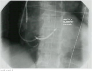 puedes ir
                          inyectando
                          contraste




jueves 24 de mayo de 12
 