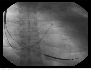 jueves 24 de mayo de 12
 