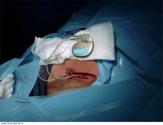 jueves 24 de mayo de 12
 