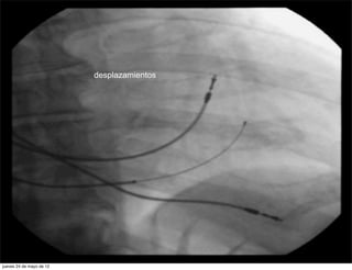 desplazamientos




jueves 24 de mayo de 12
 