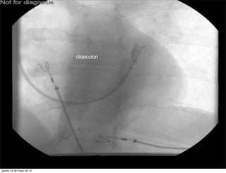 diseccion




jueves 24 de mayo de 12
 