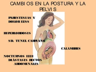 CAMBI OS EN LA POSTURA Y LA
PELVI S
PARESTESIAS Y
DOLOR EESS
HIPERLORDOSIS
SD. TUNEL CARPIANO
CALAMBRES
NOCTURNOS EEII
DIÁSTASIS RECTOS
ABDOMINALES
 
