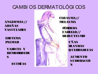 CAMBI OS DERMATOLÓGI COS
ANGIOMAS//
ARAÑAS
VASCULARES
ERITEMA
PALMAR
VARICES Y
HEMORROIDE
S
ESTRÍAS
CLOASMA//
MELASMA
PÉRDIDA
CABELLO//
HIRSUTISMO
UÑAS
BLANDAS
QUEBRADIZAS
AUMENTO
SUDORACIÓ
N
 