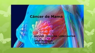Cáncer de Mama 
GEYLING CAROLINA LOPEZ GAITAN 
UNAN MANAGUA 
DICIEMBRE 2014 
 