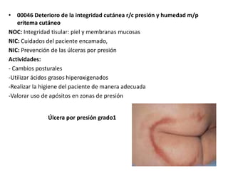 • 00046 Deterioro de la integridad cutánea r/c presión y humedad m/p 
eritema cutáneo 
NOC: Integridad tisular: piel y membranas mucosas 
NIC: Cuidados del paciente encamado, 
NIC: Prevención de las úlceras por presión 
Actividades: 
- Cambios posturales 
-Utilizar ácidos grasos hiperoxigenados 
-Realizar la higiene del paciente de manera adecuada 
-Valorar uso de apósitos en zonas de presión 
Úlcera por presión grado1 
 