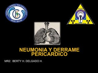 MR2: BERTY H. DELGADO H.
NEUMONIA Y DERRAME
PERICARDICO
 