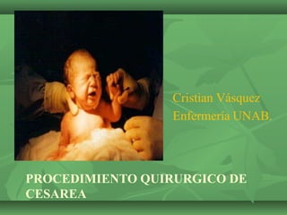 PROCEDIMIENTO QUIRURGICO DE
CESAREA
Cristian Vásquez
Enfermería UNAB.
 