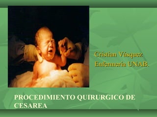 Cristian Vásquez
                 Enfermería UNAB.



PROCEDIMIENTO QUIRURGICO DE
CESAREA
 