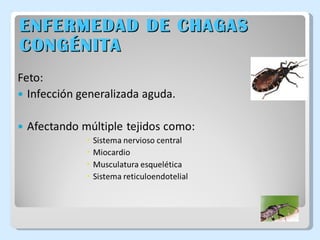 ENFERMEDAD DE CHAGAS CONGÉNITA 