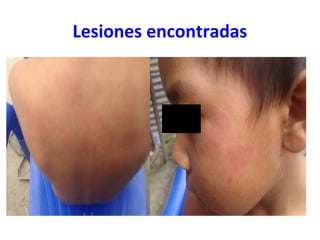 Lesiones encontradas
 