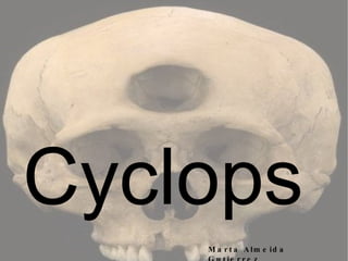 Cyclops   Marta Almeida Gutierrez 