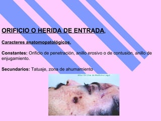 ORIFICIO O HERIDA DE ENTRADA . Caracteres anatomopatológicos. Constantes:  Orificio de penetración, anillo erosivo o de contusión, anillo de enjugamiento.  Secundarios:  Tatuaje, zona de ahumamiento   