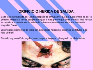 ORIFICIO O HERIDA DE SALIDA. Es la lesión provocada por la bala después de atravesar el cuerpo. Este orificio es por lo general, irregular,a veces desgarrado igual o más grande que el de entrada, todo lo cual es debido a la desviación de salida de la bala o a su deformación o a la acción de esquirlas óseas . Los mejores elementos de juicio son dos signos negativos: ausencia de tatuaje o de halo de Fish.  Cuando hay un orificio regular y otro mayor e irregular, el segundo es el de salida.   