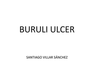 BURULI ULCER

 SANTIAGO VILLAR SÁNCHEZ
 