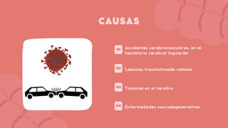 01
02
03
04
Accidentes cerebrovasculares, en el
hemisferia cerebral izquierda
CAUSAS
Lesiones traumaticasde cabeza
Tumores en el cerebro
Enfermedades neurodegenerativas
 