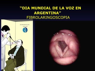 “ DIA MUNDIAL DE LA VOZ EN ARGENTINA”   FIBROLARINGOSCOPIA www.vectormysoul.com 