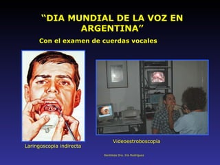“ DIA MUNDIAL DE LA VOZ EN ARGENTINA” Con el examen de cuerdas vocales Laringoscopia indirecta Videoestroboscopía Gentileza Dra. Iris Rodríguez 