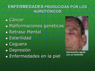 ENFERMEDADES PRODUCIDAS POR LOS AGROTÓXICOSCáncerMalformaciones genéticasRetraso MentalEsterilidadCegueraDepresiónEnfermedades en la pielIntoxicación aguda con un herbicida 