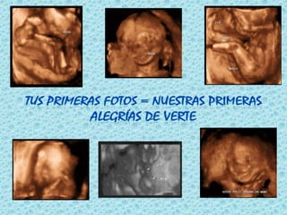 Tus primeras fotos = Nuestras primeras alegrías DE verte