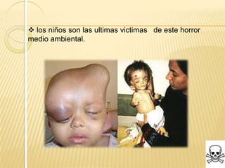  los niños son las ultimas victimas de este horror
medio ambiental.
 