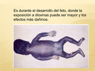 Es durante el desarrollo del feto, donde la
exposición a dioxinas puede ser mayor y los
efectos más dañinos.
 
