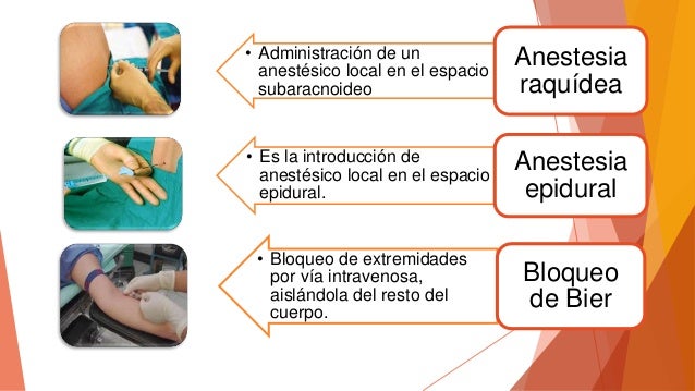 Introduccion A La Anestesia Tipos De Anestesia Images