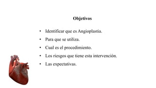 Objetivos
• Identificar que es Angioplastia.
• Para que se utiliza.
• Cual es el procedimiento.
• Los riesgos que tiene esta intervención.
• Las expectativas.
 