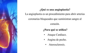 ¿Qué es una angioplastia?
La angioplastia es un procedimiento para abrir arterias
coronarias bloqueados que suministran sangre al
corazón.
¿Para qué se utiliza?
• Ataque Cardiaco.
• Angina de pecho.
• Aterosclerosis.
 