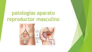 patologías aparato
reproductor masculino
 